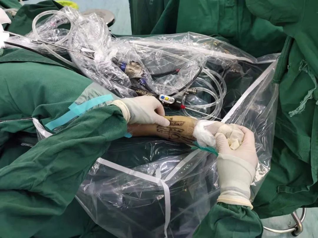 泗阳治疗脚崴的地方,泗阳哪家医院治疗脚扭伤