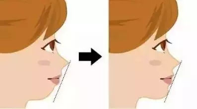 小孩子牙齿不齐多少岁矫正比较好,孩子牙齿不齐什么年龄矫正最合适