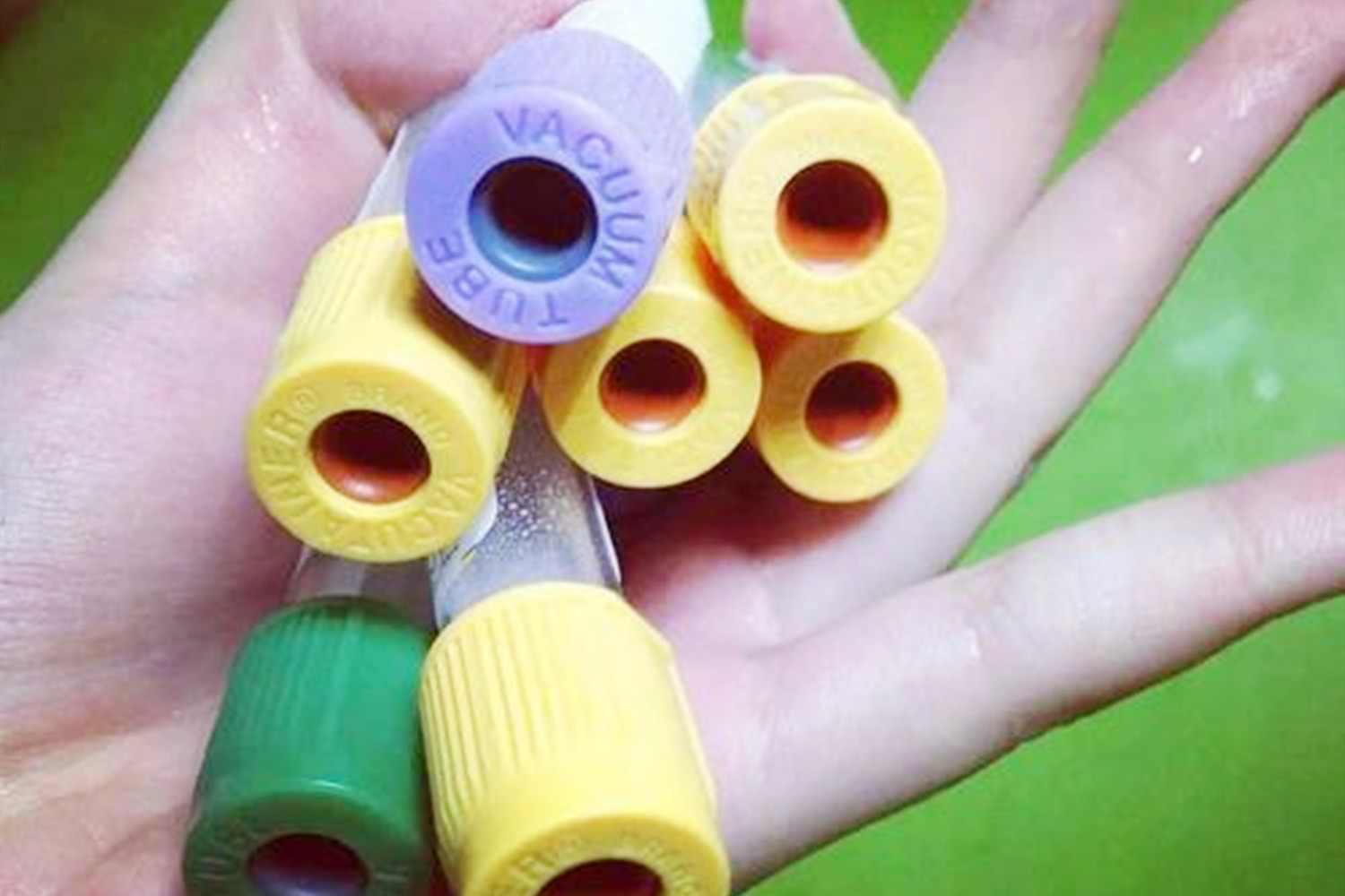 哪种血型女人生孩子危险,什么血型的男女生孩子会溶血