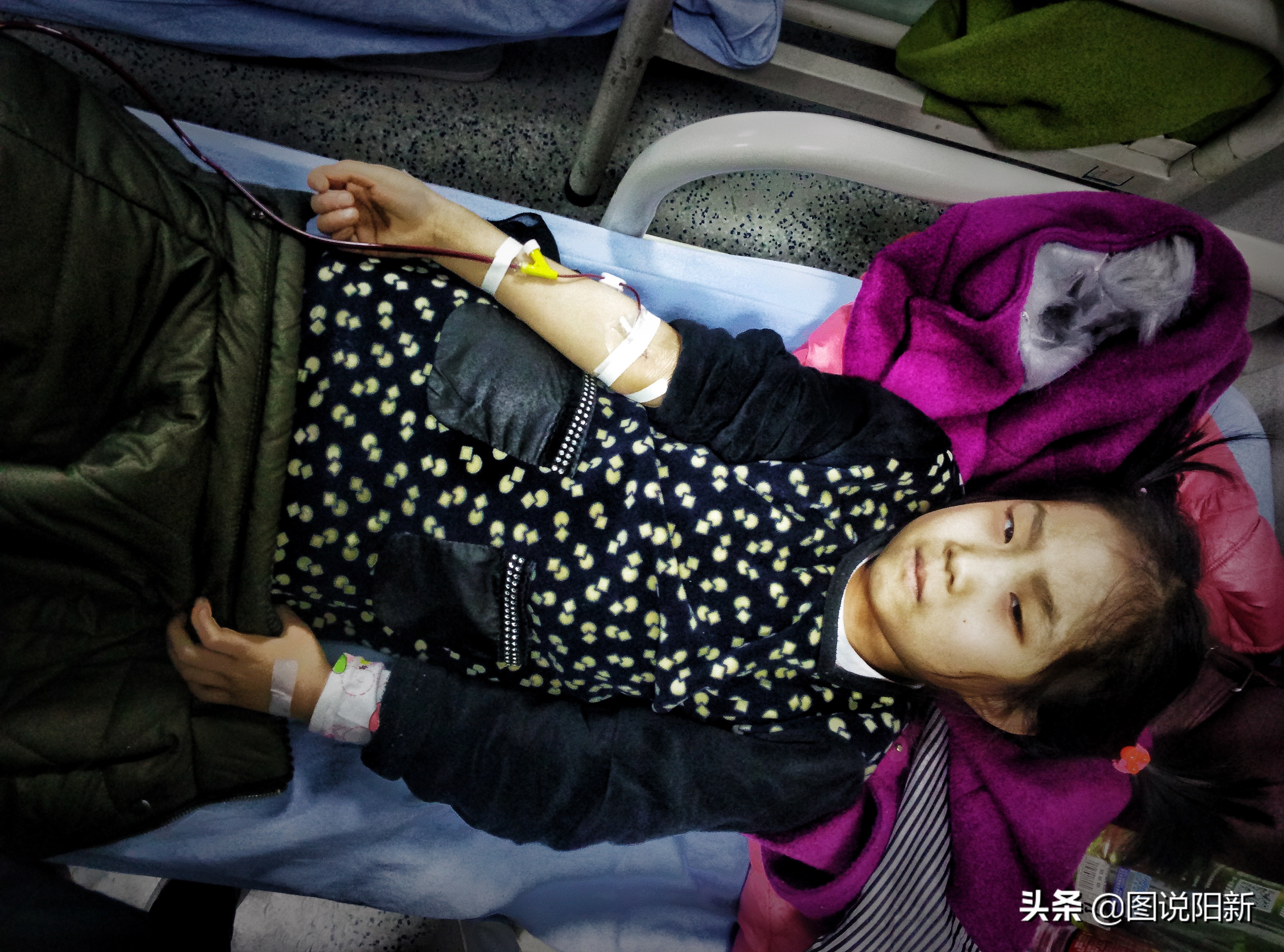 女孩患了200万分之一罕见病,女孩身患罕见怪病