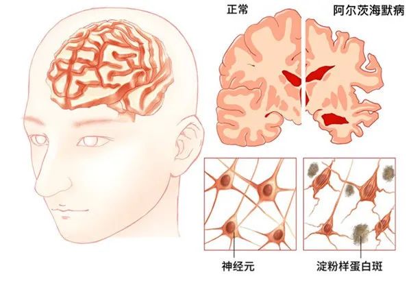 脑袋不好使是咋回事,脑袋不正是怎么回事