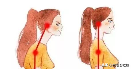 泰勒探颈毁气质？杨幂驼背变猥琐？教你1招轻松变美