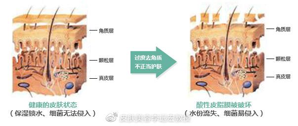 洗脸的时候脸颊刺痛发红,洗脸后脸发红是什么原理