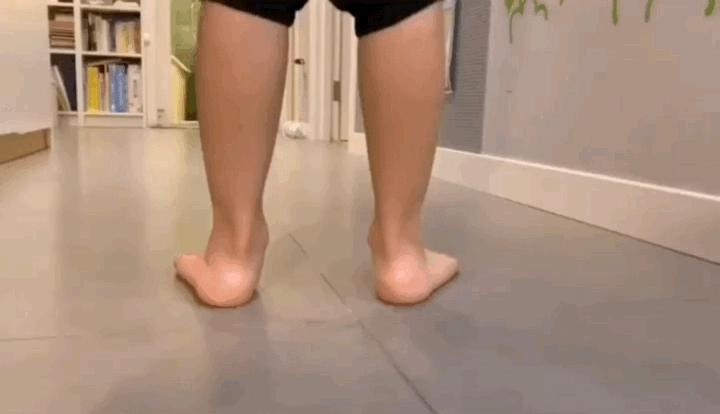 孩子走路“内八”or“外八”，可能和这3个小习惯有关