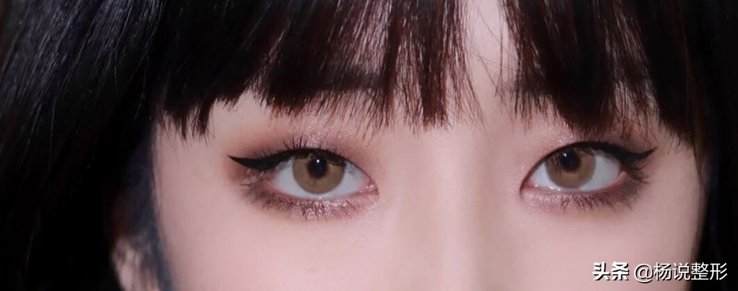 割双眼皮一定好看吗,割双眼皮真的好看吗