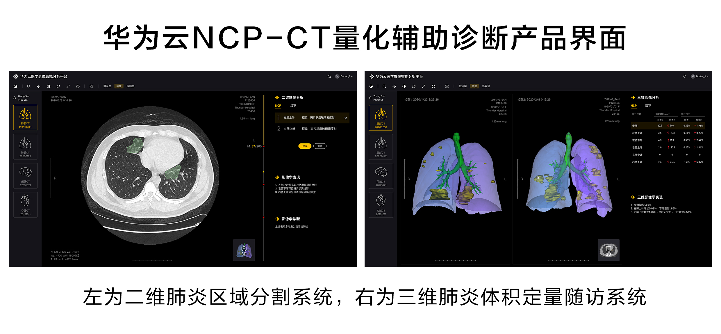 华为发布智能医疗云平台,华为aict诊断技术