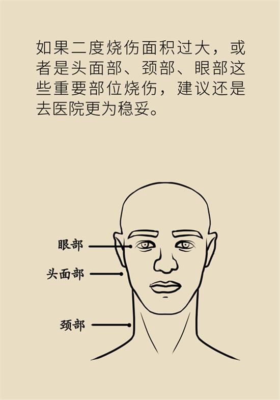 烫伤水泡如何换药,深2度烫伤换药总是有大水泡