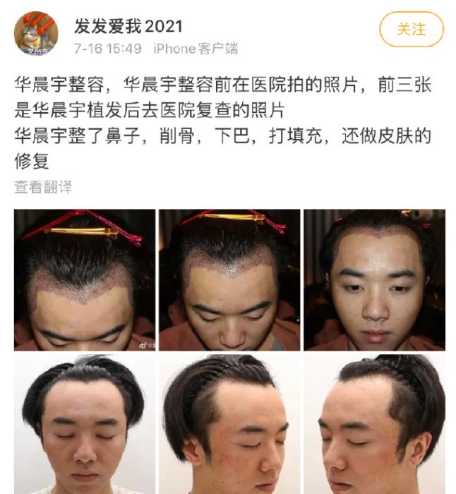 华晨宇整容风波后毫发无伤，公开露面参加活动，他该给吴亦凡打钱