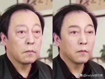 中药去眼袋的有效方法,去眼袋最有效的方法牙膏