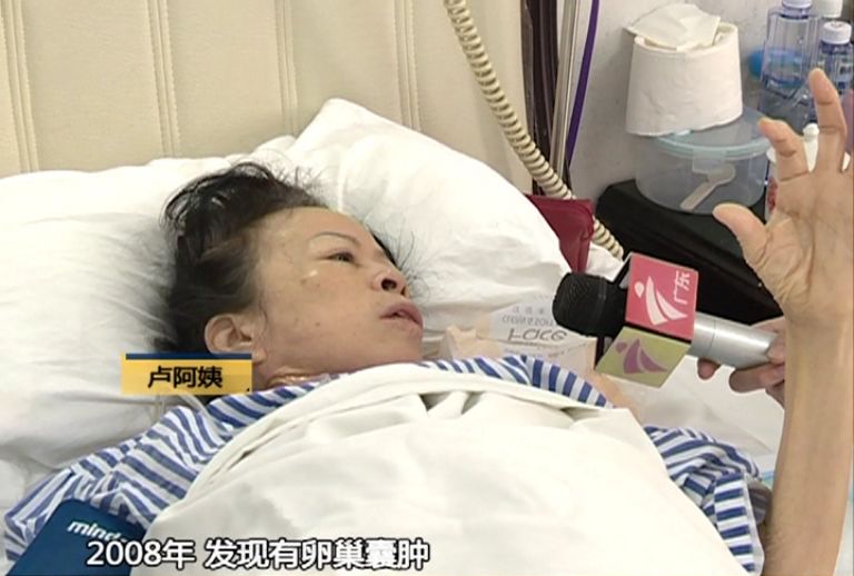 61岁阿姨肚凸如身怀六胞胎，没想到是11年前留下的“祸根”