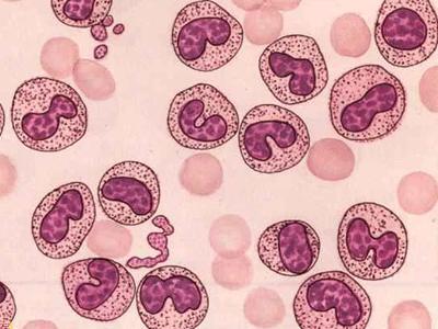 猫咪身体发热呕吐,猫咪身体很热又拉肚子