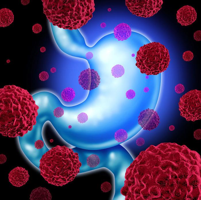 如果发现黑便该怎么处理,出现黑便需警惕你可能得了这些病