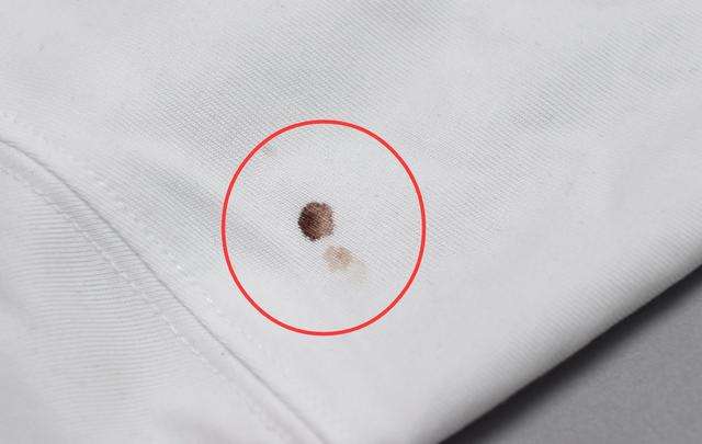 如何快速去除衣服上凝固的血渍,衣服上有血渍如何快速清洗