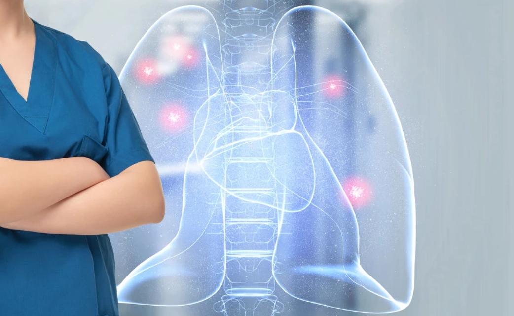 肺结核合并肺癌可以化疗吗,肺结核治疗需要化疗吗