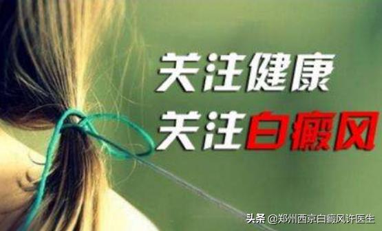 白癜风稳定期还得治疗吗,处于稳定期的白癜风