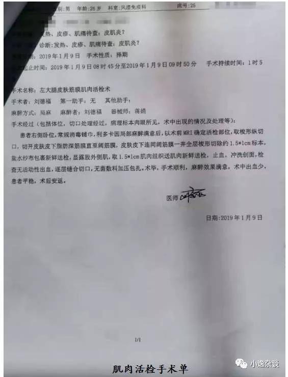 皮肌炎病史,皮肌炎二十年没有治疗