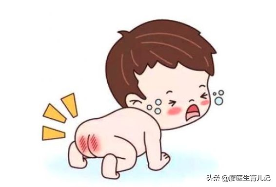 宝宝红屁股的如何预防和护理,宝宝红屁股怎么办教你一招
