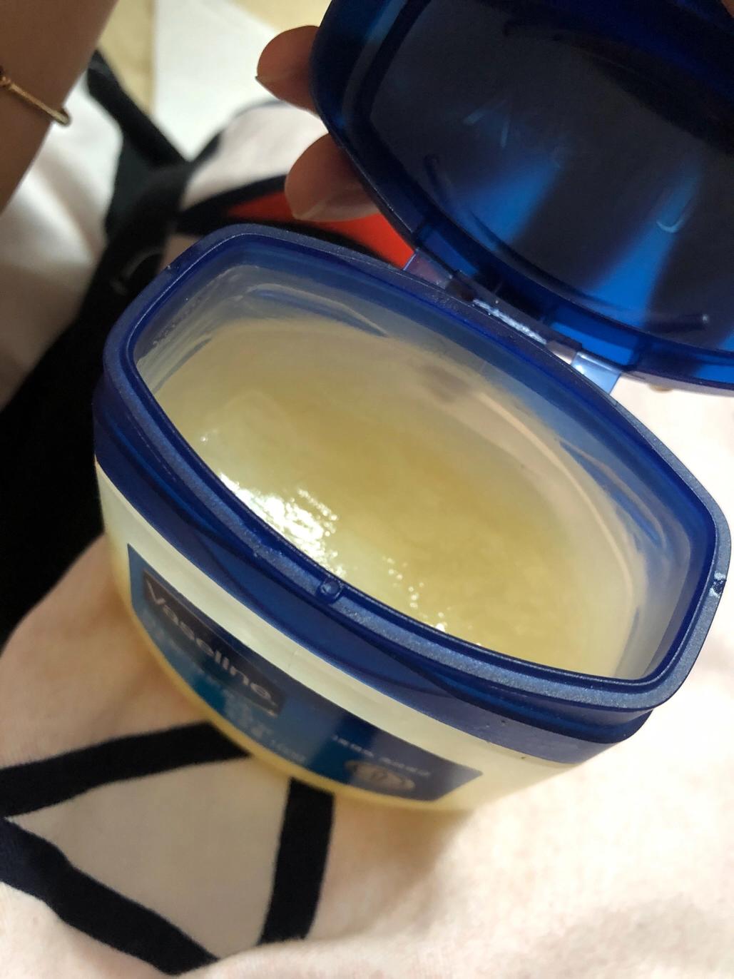 刚开始的唇炎的症状及治疗方法,唇炎持续两三年了不会是唇炎吧