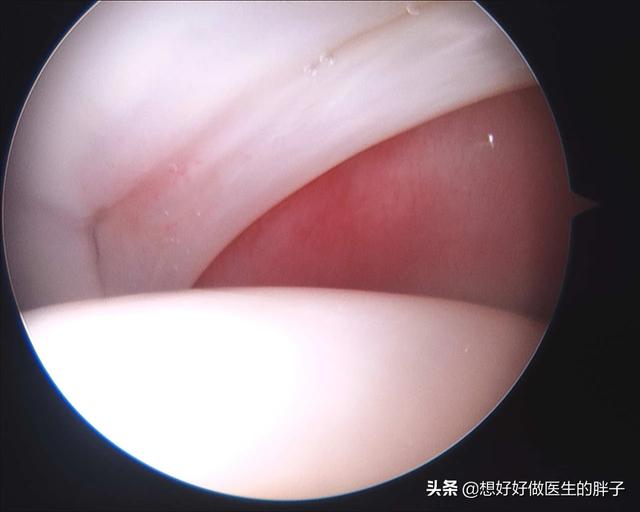 髋关节疼痛会引起腿痛吗,髋关节疼痛两腿不一样长如何康复
