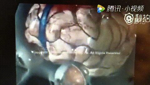 哄宝宝睡觉怎样摇晃不会影响宝宝,不要剧烈摇晃孩子哄睡