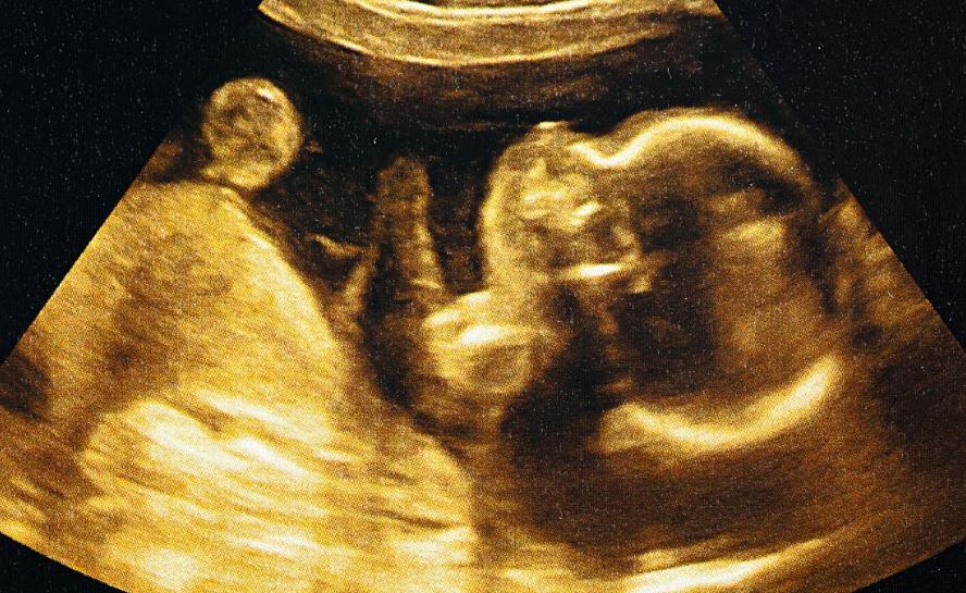 怀孕初期正常孕酮值和hcg值是多少,怀孕初期孕酮值和hcg值多少算正常