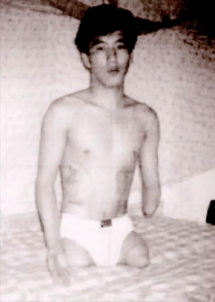 捡金属链子核辐射截肢,核辐射链子被工人捡到