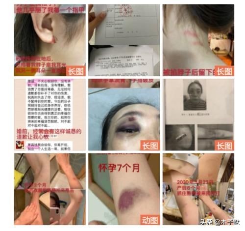 张漠寒家暴后续,张漠寒张培萌最新视频