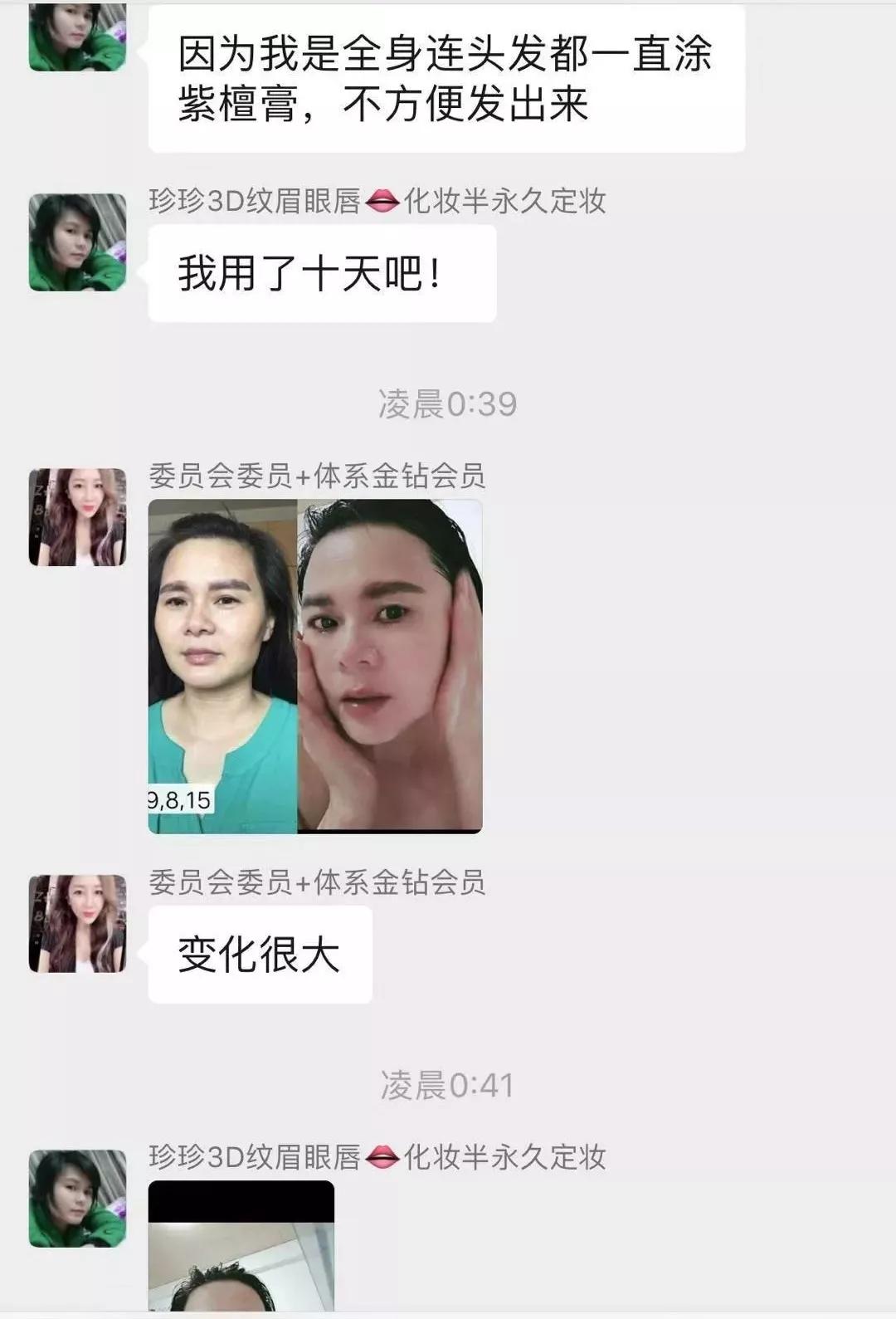 一招帮你搞定淡化法令纹,教你一招二天消除法令纹