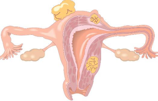 女性频繁腹痛,要引起重视,或与4种妇科疾病有关,需警惕