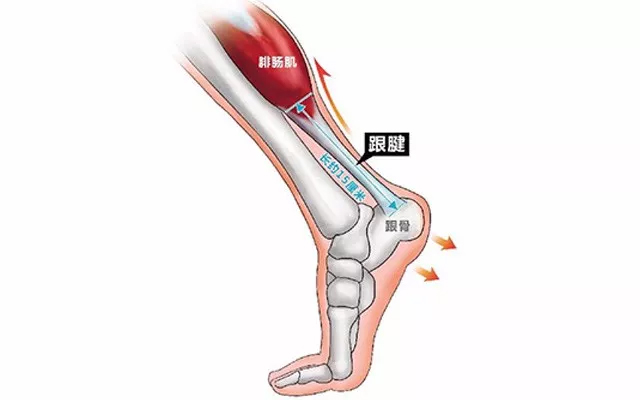 跟腱炎一般多久能自愈,止点性跟腱炎多久恢复