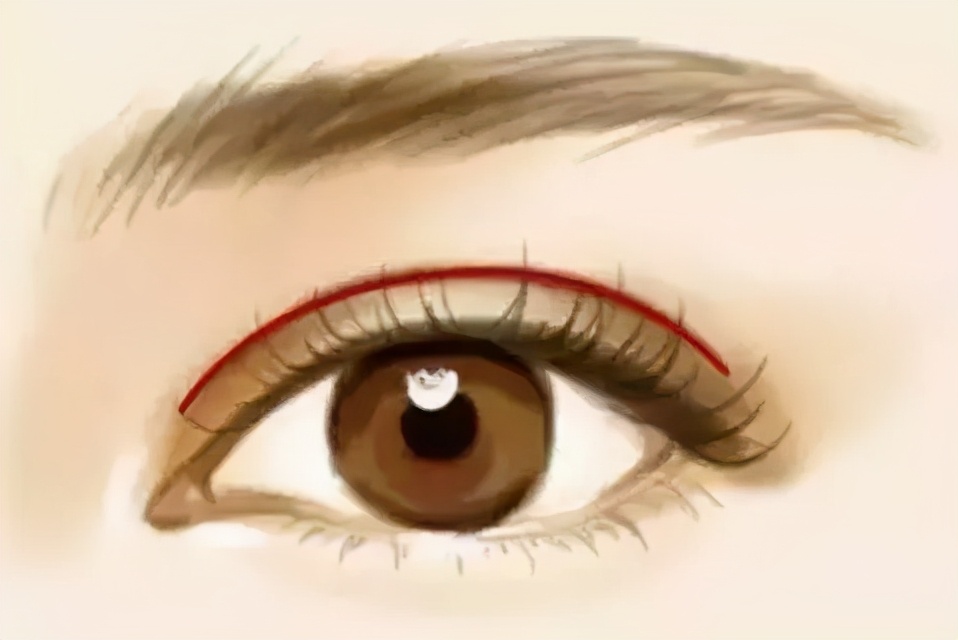 双眼皮不要盲目跟风,别割双眼皮