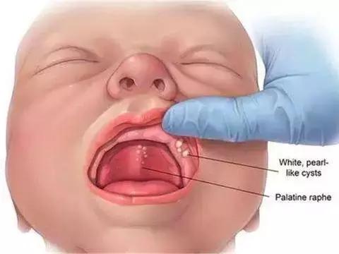 育婴师怎么处理宝宝疾病,育婴员关注婴幼儿发育状况