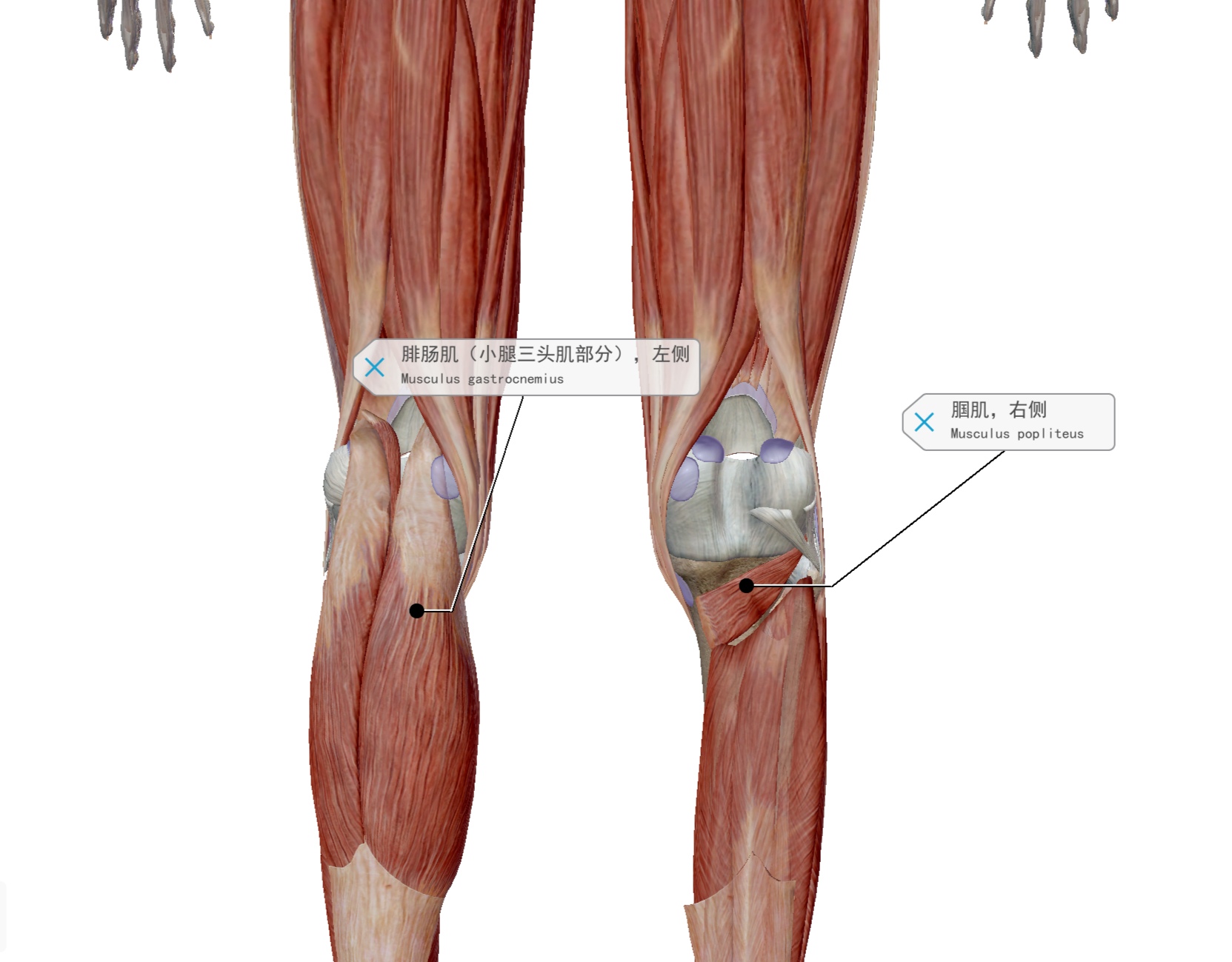 腘肌与膝盖疼痛,膝盖的腘肌