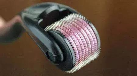 光子嫩肤微针,微针光子嫩肤