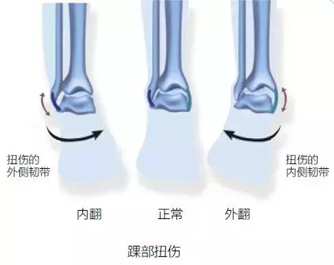 跑步新手应该了解的运动知识,跑步运动基础知识