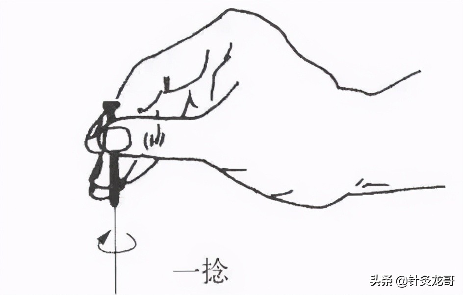 针灸痛酸胀哪个程度更严重,针灸时疼痛难忍是什么原因