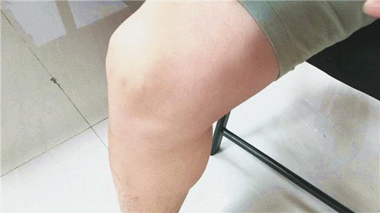 蚊子咬你都有哪些原因,蚊子咬你的真正原因是什么