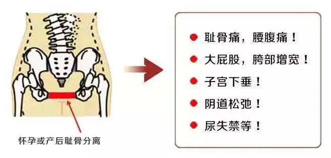 杨丽萍为什么不能生育,杨丽萍回应不生孩子争议