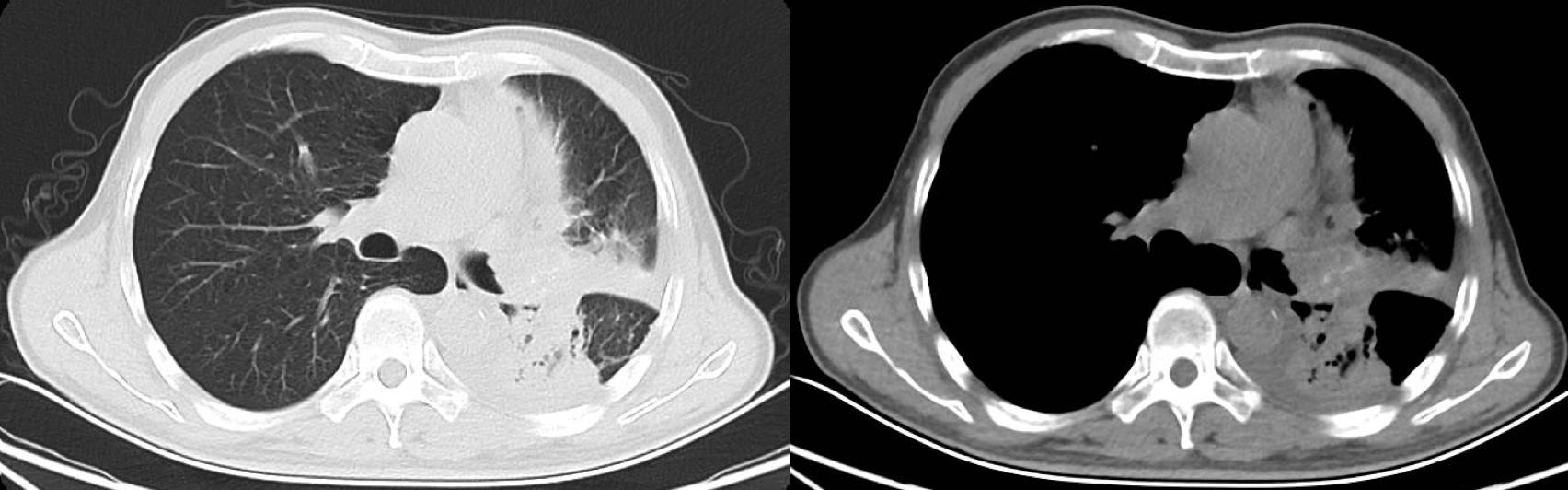 抗癌药物选择,如何选择抗癌药