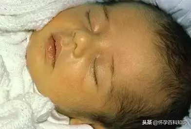 新生儿30个常见问题及处理技巧,新生儿一个月常见问题