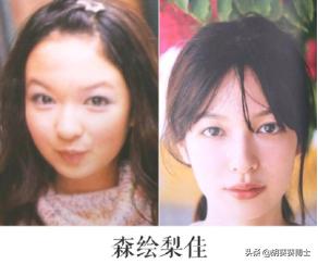 日本整容失败面目全非的10大女星,日本整容最成功的女星
