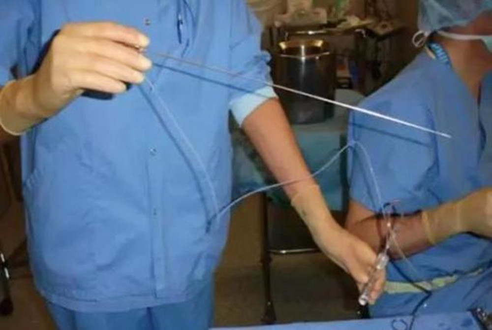 90后夫妻备孕趣事,90后夫妻备孕辛酸