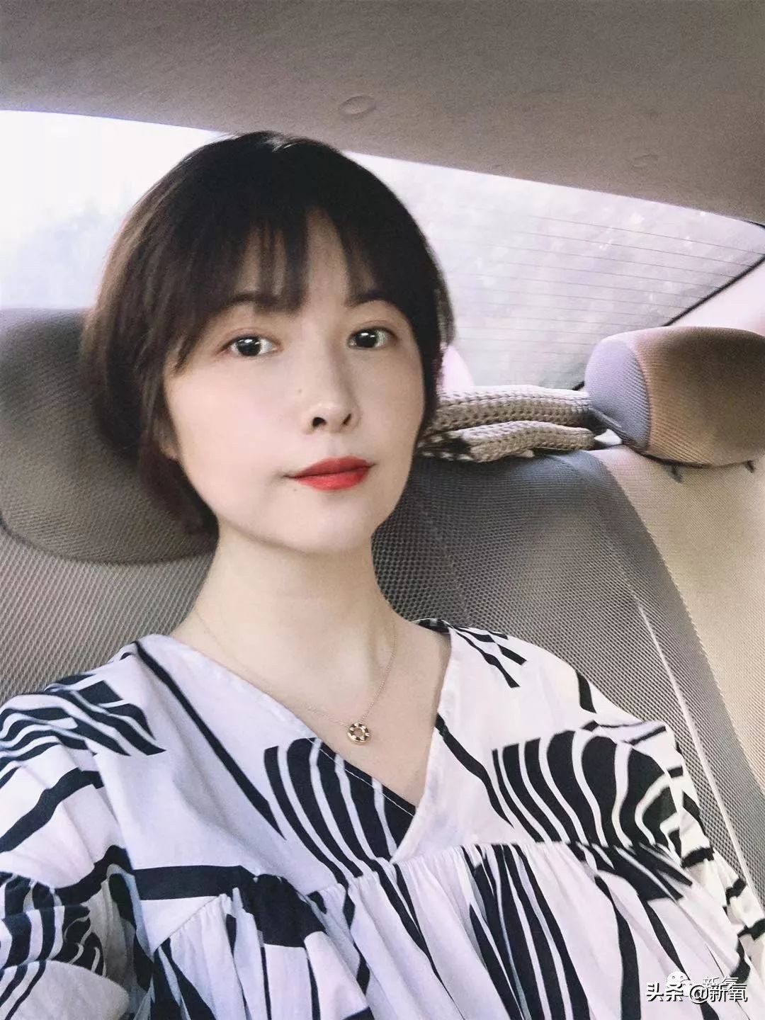 迷死氧亲身体验,我在日本吸掉了一桶脂肪和半张脸