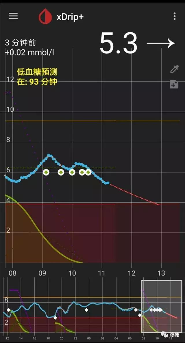 闭环式胰岛素泵会低血糖吗,闭环胰岛素泵使用寿命