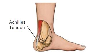 在家躺了几个月不出门了怎么办,跟腱躺着会断吗