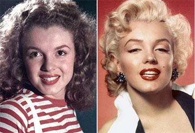 世界第一例整容手术如何诞生的,世界上最早出现的整形医院