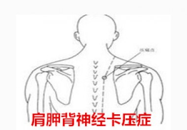 颈肩背部不舒服会不会是脑部问题,肩颈痛是不是颈椎病引起的
