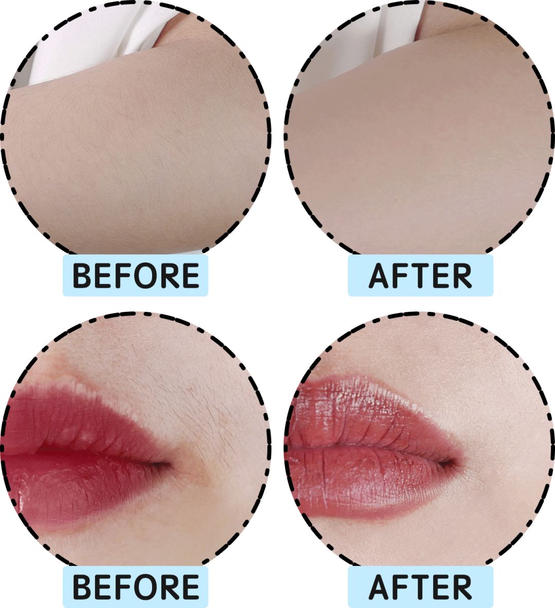 网红脱毛仪器家用评测,网红脱毛仪哪个好用又便宜