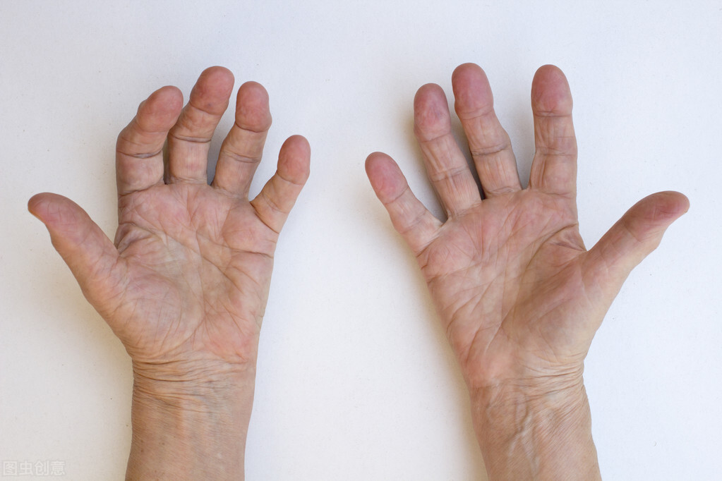 痛风脚关节疼吃什么方剂,痛风脚关节痛食谱