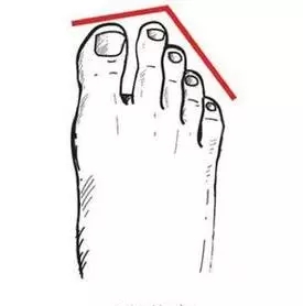 脚型不好看不敢穿凉鞋怎么办,什么脚型适合穿什么高跟凉鞋